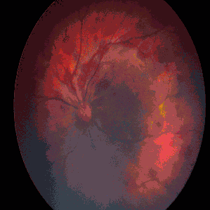 Pr3vent-Provectus-ML-6