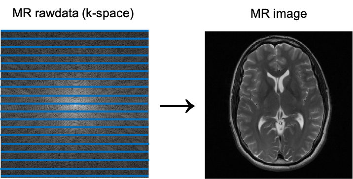 Image 1. K-space and corresponding brain MR Image. Courtesy of Florian Knoll.
