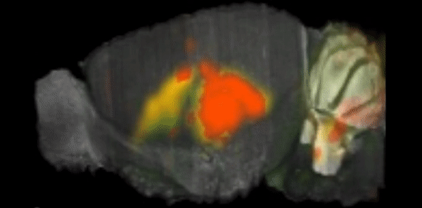 Figure 1. This video was captured from the Allen Mouse Brain Atlas dataset via mouse.brain-map.org.