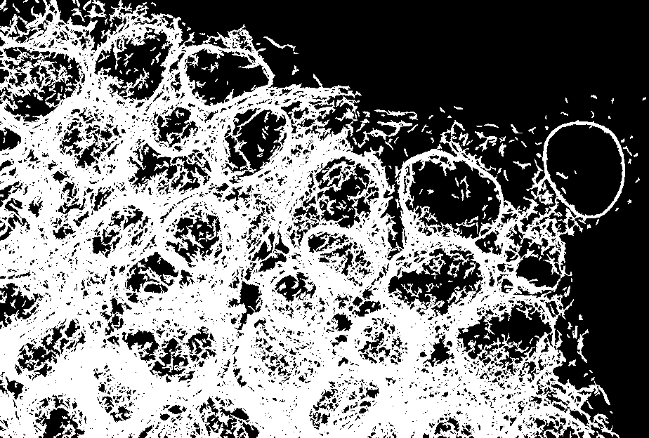 Figure 4. This image, available with Quilt Data through an AWS partnership, shows the endoplasmic reticulum illuminated in human iPS cells as part of the Allen Cell Collection.